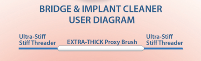 Proxy Soft Bridge Implant User Diagram